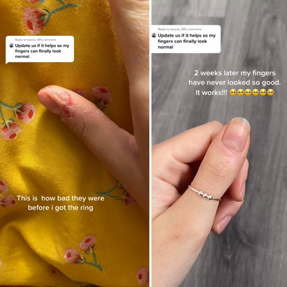 The Fidget Bead Ring